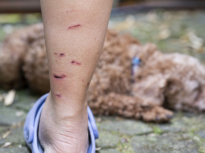  Puncture marks on Joyce Gee’s legs continue to heal after an unprovoked raccoon attack left her and her dog with wounds.