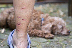 Dūrimo žymės ant Joyce Gee kojų ir toliau gyja po to, kai dėl neprovokuoto meškėno atakos ji ir jos šuo buvo sužeistos.