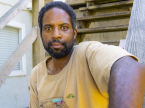 Rufus McIntyre, pictured after an alleged assault by a jet boater Sunday, July 24, on the Vedder River in Chilliwack. The 40-year-old sustained fractures to his nose and cheekbones.