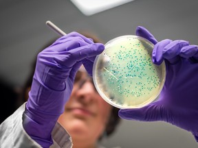 A bacterial culture plate is being examined by a female researcher in microbiology laboratory in this file photo.