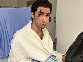 Abdullah Darwich, a 19-year-old nonverbal teenager, is shown in a family handout photo taken in a hospital after he was allegedly tasered and handcuffed by police on Nov. 4 in Mississauga, Ont., after officers responded to a report about a suspicious person.