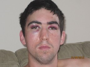 Kyle Mockford shortly after suffering a traumatic brain injury in 2012.