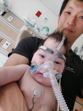 Davis Lim with his one-year-old baby Theo, a day after doctors performed a tracheotomy to help him breathe.