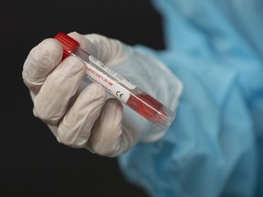 The BC Centre for Disease Control has detected Canada's first known case of a new COVID-19 variant that has emerged in several other countries and is being monitored by the World Health Organization. A nurse holds a vial containing a patients test swab at the National Arts Centre Wednesday Nov. 18, 2020 in Ottawa.