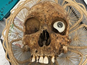 A human skull was donated to a Goodwill in Arizona this week, police say. It came with a false eye and missing jaw. It has not been determined yet how old it is.