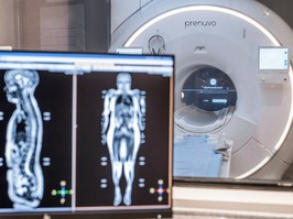 prenuvo offers private magnetic resonance imaging (mri) scans of the entire body.