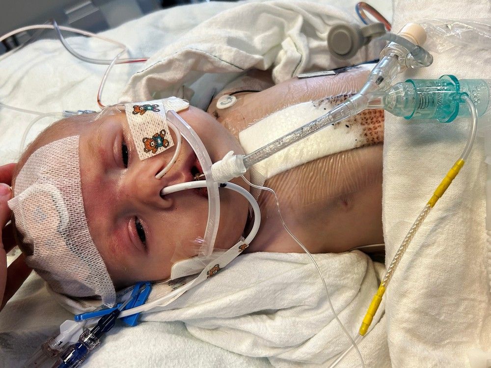 一项突破性手术如何拯救了这名加拿大不列颠哥伦比亚省婴儿的生命