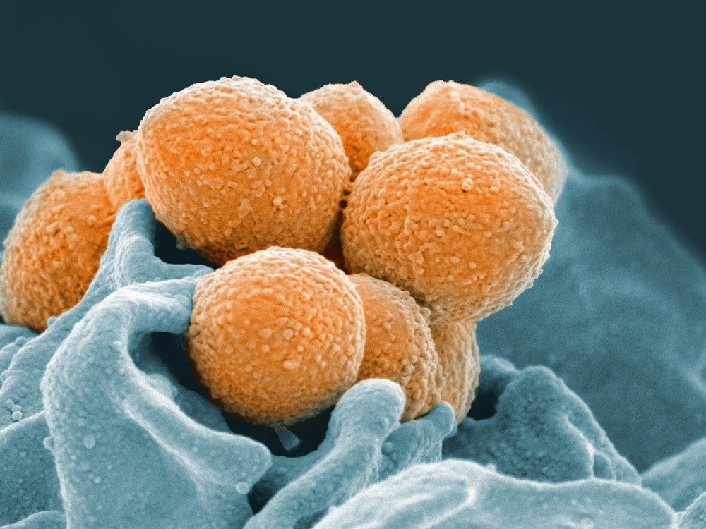 A bulletin released by the B.C. Centre for Disease Control, the Provincial Health Services Authority and B.C. Children's Hospital says data from 2023 show a three-fold increase in invasive group A streptococcal infections in people under 20. THE CANADIAN PRESS/AP-NIAID via AP