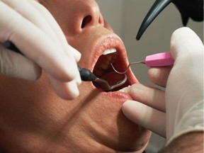 Canadian Dental Care Plan: Who’s eligible and what’s covered?
