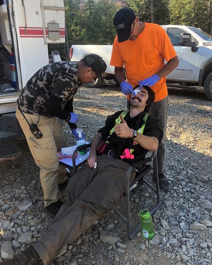 Handout photo of Irish national Jake McGavin, a team leader with a B.C. wildfire-fighting contractor, Carmanah Wildfire, as he is treated for an injury while on the job. Jake’s in his third season fighting wildfires in B.C. Handout photo of Irish national Jake McGavin, a team leader with a B.C. wildfire-fighting contractor, Carmanah Wildfire, as he is treated for an injury while on the job. Jake’s in his third season fighting wildfires in B.C.
