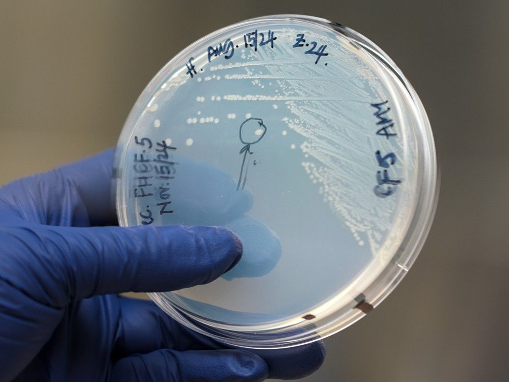  Vibrio bacterium on the plate. B.C. researchers have discovered the cause of billions of sea stars dying from a wasting disease.