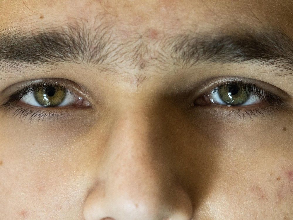 Dominic Juillette recently had gene therapy surgery in Vancouver — a first in B.C. — that has restored his night vision. Dominic Juillette recently had gene therapy surgery in Vancouver — a first in B.C. — that has restored his night vision.