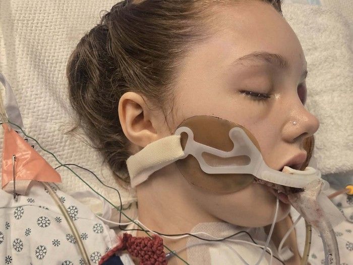 Maya Gebela, who was shot at Tumbler Ridge Secondary School on Feb. 10, remains in critical condition in B.C. Children's Hospital. 