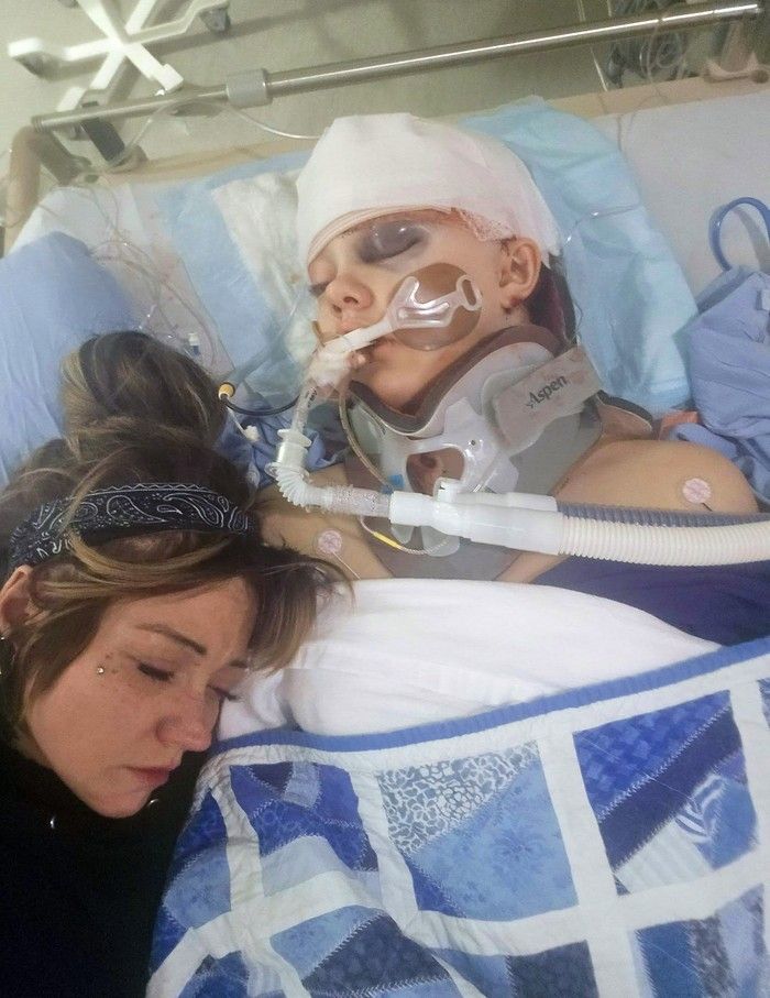  Cia Edmonds posted a photo on Facebook of her daughter 12-year old Maya in B.C. Children’s Hospital in Vancouver, showing the young Tumbler Ridge victim with severe injuries and medical support as she pleads for a miracle amid warnings of irreversible brain damage.