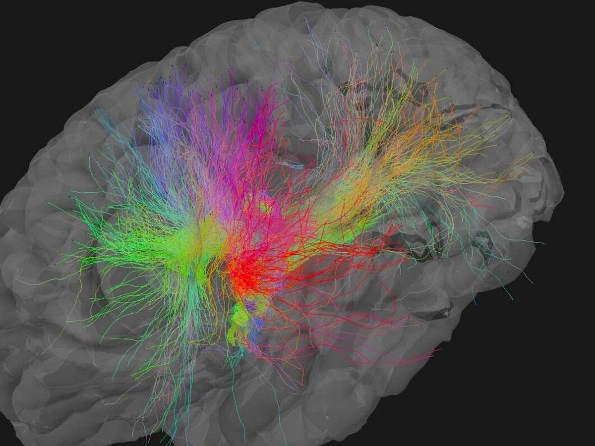Brain project at SFU aims to discover why some people don't get dementia, despite risk factors