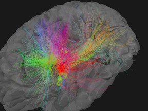 brain image