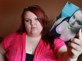Kassandra Grondin, 23, holds a photo Saturday, Oct. 20, 2012, of a third-degree burn she allegedly received on her chest after applying Banana Boat Sport Performance 60 Mist May 5th, 2012.  (DAX MELMER/The Windsor Star)