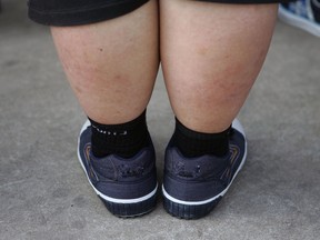 File photo of an overweight child. (Windsor Star files)