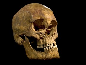 An undated handout picture released on February 4, 2013 from the University of Leicester shows the full skull of the skeleton of king Richard III found at the Grey Friars Church excavation site in Leicester. Researchers from the University of Leicester said DNA from the 500-year-old skeleton, which has battle wounds and a curved spine, matched a 17th generation descendant of the king's sister, Canadian-born carpenter Michael Ibsen. AFP PHOTO/HO/UNIVERSITY OF LEICESTER