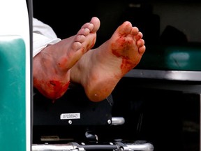 Blood-stained feet of a man hangs outside an ambulance outside a medical tent located near the finish of the 117th Boston Marathon after two bombs exploded on the marathon route on April 15, 2013 in Boston, Massachusetts. Two people are confirmed dead and at least 23 injured after two explosions went off near the finish line to the marathon. (Jim Rogash/Getty Images)