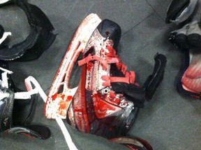 Eric Wellwood's bloodied skate after  the 23-year-old former Windsor Spitfires forward and Philadelphia Flyers prospect severed two tendons in his leg when he slid feet first into the boards during an American Hockey League game. Another tendon, his Achilles, and an artery were also 70 per cent severed two weeks ago. (Photo courtesy of the Wellwood family).