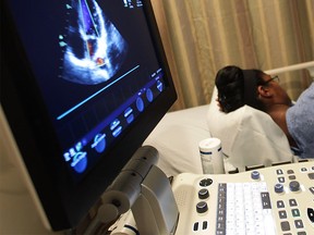 An echocardiogram is performed on a patient at Hotel-Dieu Grace Hospital in this May 2012 file photo. (Dan Janisse / The Windsor Star)