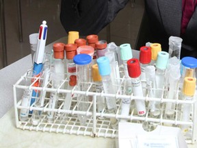 File photo of test tubes. (Windsor Star files)