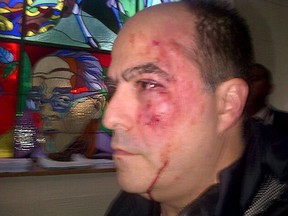 Handout picture released by the Primero Justicia party press office showing opposition deputy Julio Borges after a fight with the ruling party deputies inside the Venezuelan parliament, in Caracas on April 30, 2013. The brawl sparked off after opposition congressmen were denied the floor by pro-government lawmakers, on the grounds that their party fails to recognize President Nicolas Maduro's win on last April 14 presidential election. AFP PHOTO / PRIMERO JUSTICIA PRESS OFFICE
