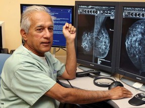 Dr. Winston Ramsewak, a radiologist and Erie St. Clair Regional Cancer Program Breast Imaging Lead, said local hospitals never used the digital computed radiography technology which a recent study says is less effective at detecting breast cancer. He is shown here at Windsor Regional Hospital's Met campus with digital direct radiography mammogram images which are compared to a digital photograph. (NICK BRANCACCIO/The Windsor Star)