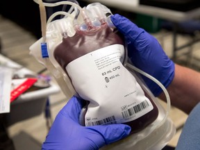 A new study shows that surgury without blood transfusions can actually benefit the patient with a better recovery. (Canadian Press files)