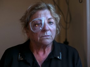 Marie Gauvin, from Tecumseh, was an innocent bystander in Ireland when a fight broke out near where she stood. A beer bottle was thrown and hit her right eye, which also fractured three places on her face. (Courtesy of
The Irish Independent newspaper)