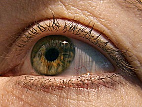 Glaucoma is a very serious disease but with routine eye exams and early detection, the visual damage can be minimized. ( KAREN BLEIER / AFP / Getty Images)