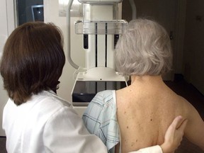 A woman is prepared for a digital mammogram. (Canadian Press files)