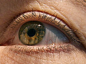 One ophthalmologist says it’s not necessary to use invasive procedures to diagnose some generalized chronic health problems. The clue is what doctors see when examining the retina. (KAREN BLEIER / AFP / Getty Images files)