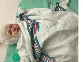 Four-month-old baby Aubree McCormick, severely burned last week when a firework shot into her cradle on the Fourth of July.