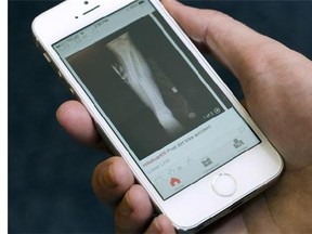 The app Figure 1 is shown on an iPhone in Toronto on Wednesday, Aug. 20, 2014. Scrolling through the latest made-in-Canada app success story can turn your stomach in seconds. Figure 1 has been called "Instagram for doctors" and in just over a year it has attracted more than 125,000 doctors, nurses and medical students who use the app to share images of rare, interesting or confounding conditions they encounter on the job. THE CANADIAN PRESS/Graeme Roy