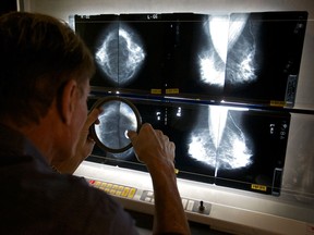 A radiologist checks mammograms in Los Angeles, in this May 2010 photo. Drs. Oz and Roizen recommend women should get regular mammograms in their 50s and beyond.  (Damian Dovarganes / Associated Press files)