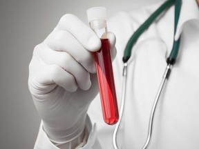 Doctor holding a bottle of blood sample. (Fotolia)