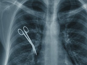 Medical scissors showing in an X-ray.
Photograph by: File photo , National Post