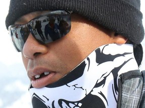 Tiger Woods walks in the finish area of the women's World Cup super-G Monday in Cortina d'Ampezzo, Italy with a noticeable gap in his front teeth. (AP Photo/Armando Trovati)