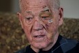 Irving McLeod, 81, recovers slowly after slipping on ice and falling face-first into the concrete near his Canada Post community letter box on Misty Dawn Street on Thursday, Feb. 12, 2015. (NICK BRANCACCIO / The Windsor Star)