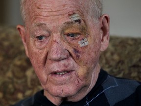 Irving McLeod, 81, recovers slowly after slipping on ice and falling face-first into the concrete near his Canada Post community letter box on Misty Dawn Street on Thursday, Feb. 12, 2015. (NICK BRANCACCIO / The Windsor Star)