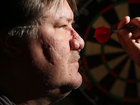 Matt Campbell says the key to being a good dart player is mostly confidence. (TYLER BROWNBRIDGE / The Windsor Star)