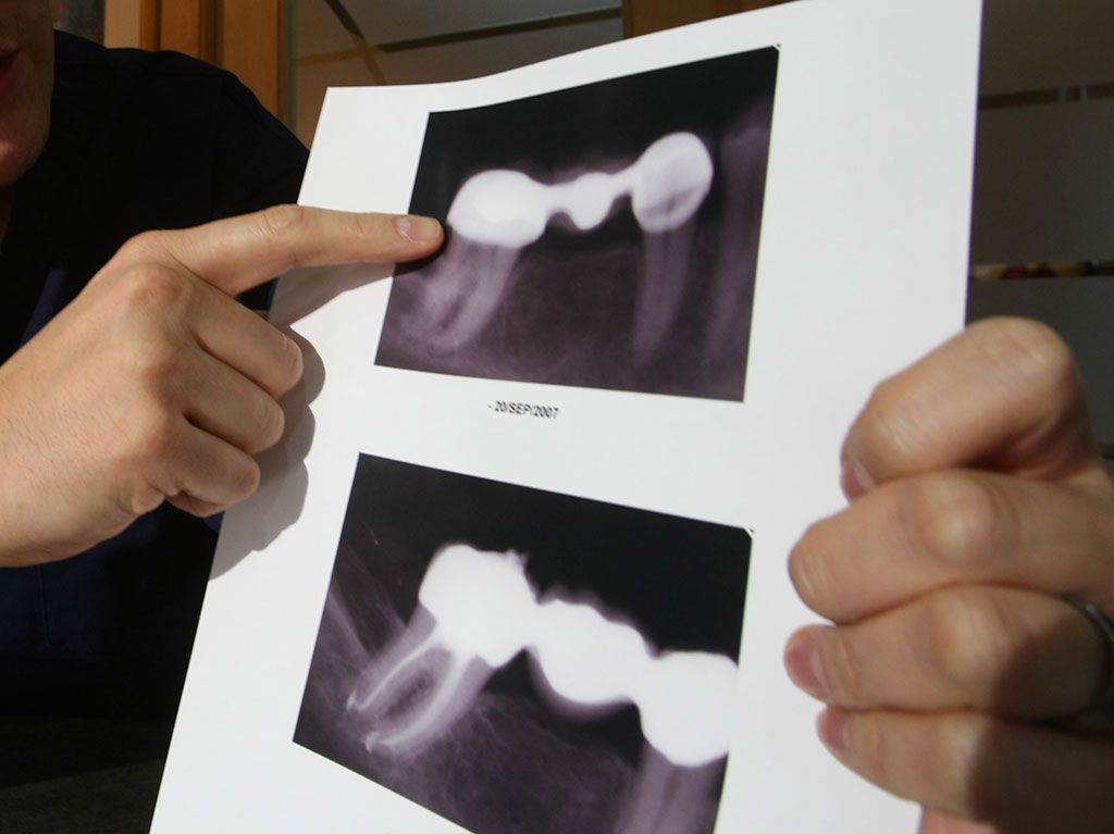 Dr. GiffordJones How necessary are dental Xrays? Windsor Star