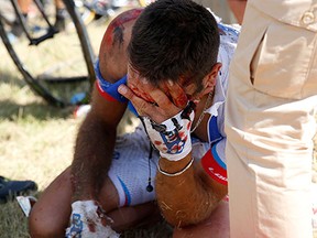 William Bonnet of France holds his head after crashing with scores of other riders during the third stage of the Tour de France cycling race over 159.5 kilometers (99.1 miles) with start in Antwerp and finish in Huy, Belgium, Monday, July 6, 2015. Bonnet abandoned the race following the crash. (AP Photo/Christophe Ena)