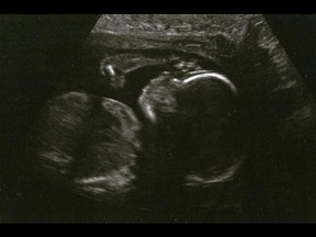 An ultrasound image of Cassandra Kaake's unborn daughter, who was going to be named Molly. Kaake was seven months pregnant when she was murdered in Windsor in December 2014.