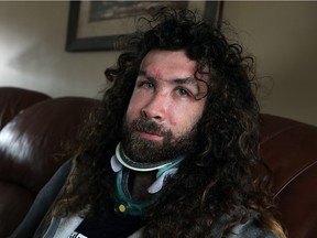 Eric Adams recovers at his parents South Windsor home on March 22, 2016. Adams was struck by a vehicle while skateboarding in Santa Cruz and has incurred a massive medical bill.