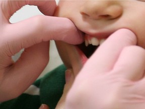 Alexander Wacheski, 2, has his teeth examined by Karen Kelly, left, a dental hygienist at the Windsor Essex County Health Unit.