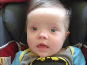 Ryker Housden, of Windsor, was born with Down syndrome last August.