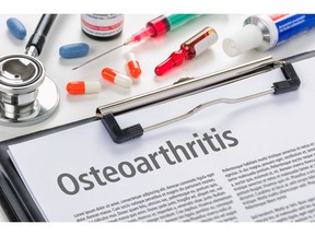 Osteoarthritis diagnosis written on a clipboard. Photo by Getty Images.